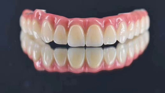 kaufen Dentallabor angepasst Implantat unterstützt Metallkrone natürlich auf der Suche nach langfristiger Stabilität Online-Herstellung