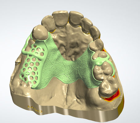 kaufen Digitales Metallrahmen CAD CAM Zahndesign Cocr-Material mit 3D-Druck Online-Herstellung