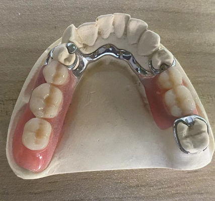 kaufen Zuverlässiger Silbermetallrahmen, Korrosionsbeständiges Zahnersatz mit individualisierbarem Design Online-Herstellung