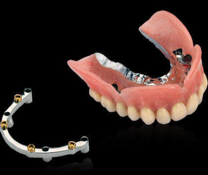 kaufen Schraube für Zahnimplantate aus gefertigtem Titan mit glatt polierter Oberfläche Online-Herstellung