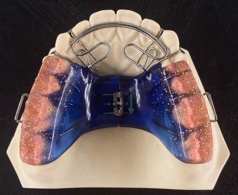 Hochgenaue orthodontische Abnehmegeräte Sicherheit Clear Hawley Retainer