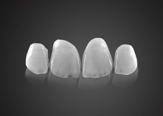 IPS 0.2mm Ultrafeine Emax Veneers mit hoher Festigkeit