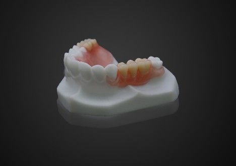 Leichtgewicht Komfortabel Valplast Teilprothese Einfache Reinigung Hohe Transparenz